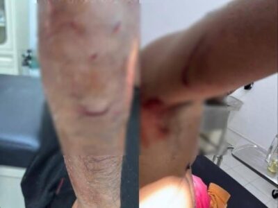 A crocodile attacks fisherman on the Río Lagartos seawall